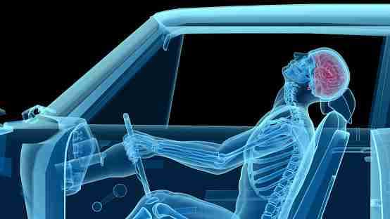 X-ray in Beaumont