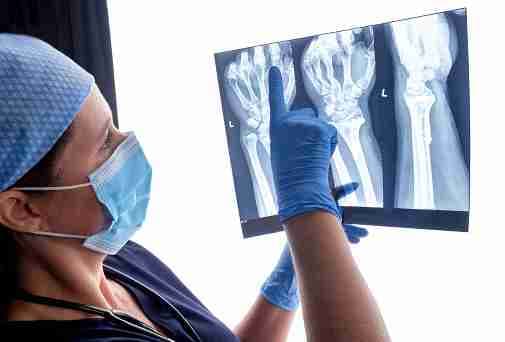 X-ray in Beaumont