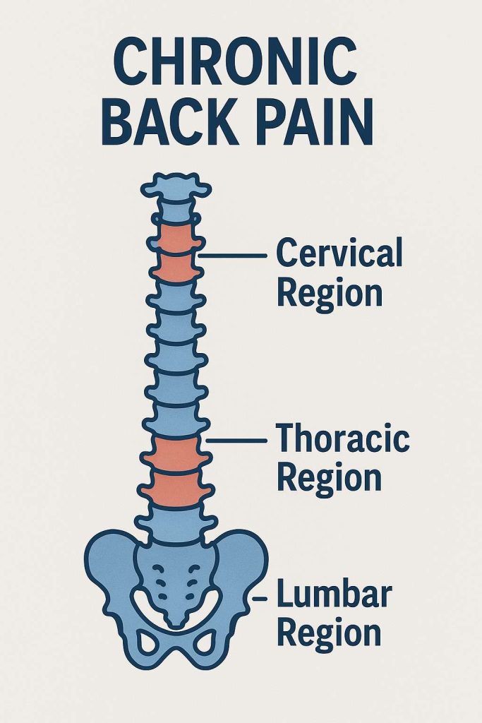 chronic back pain Beaumont