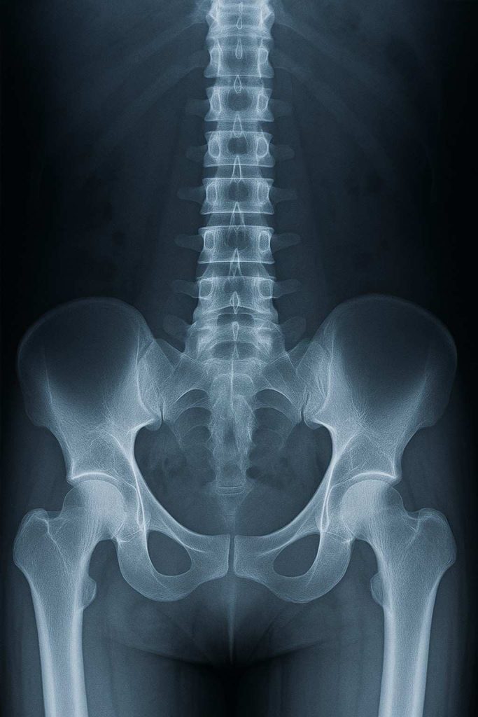 Human Spine X-ray image